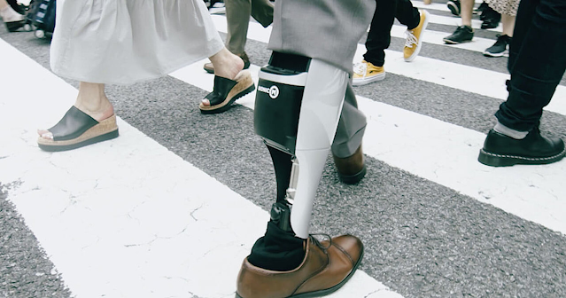 Design Concept 2020 - Robotic Prosthetic Knee by BionicM Inc.