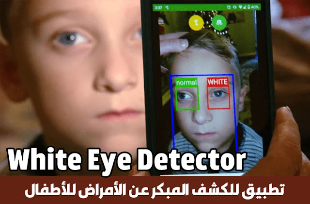 تطبيق White Eye Detector للكشف المبكر عن الأمراض للأطفال