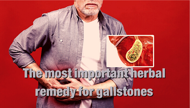 Gallstones are pieces of solid material that form in the gallbladder, the small organ under the liver, and vary in size from a grain of sand to a golf ball, which can cause pain and require immediate treatment.