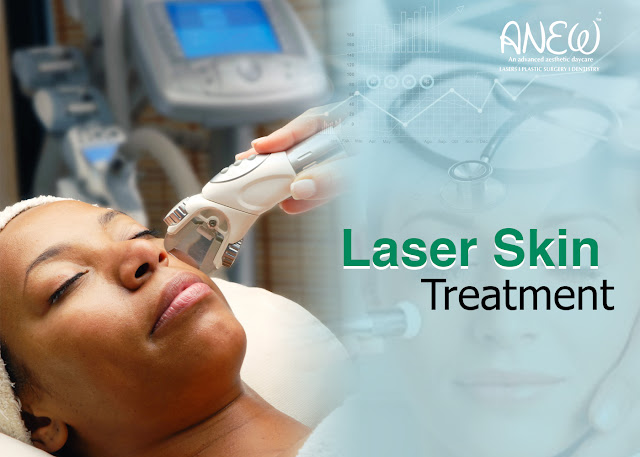 Laser Skin Treatment