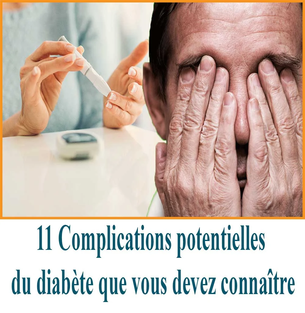 Complications potentielles du diabète que vous devez connaître