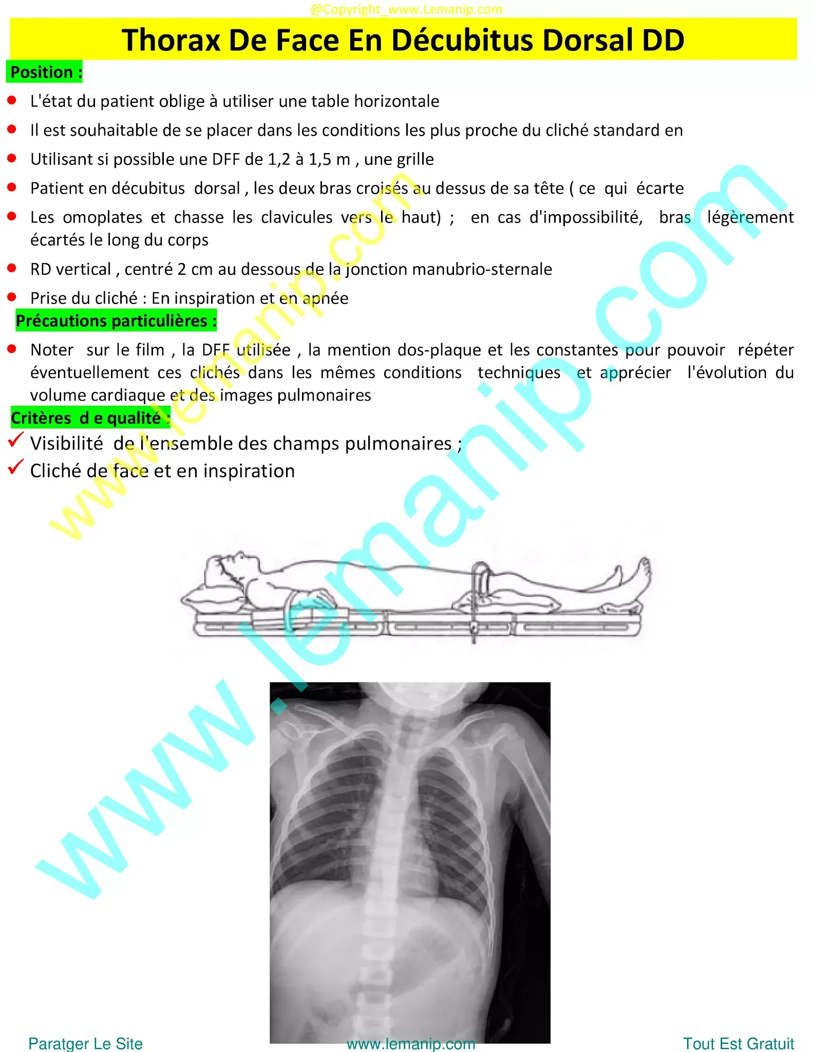 mesothelioma chest x ray,asbestos lung x ray,asthma chest x ray,asthma lungs x ray,urgent care with chest x ray near me,chest xray pa and lateral,ppd chest x ray,chest xray tb,chest x ray pa and lateral,chest xray pa lateral