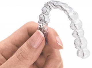 Chi phí niềng răng không mắc cìa 3D Clear -1