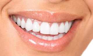 Quy trình niềng răng lệch lạc tại nha khoa-2
