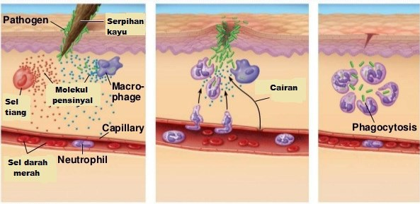 Gambar   Mekanisme pertahanan tubuh dengan respon inflamatori