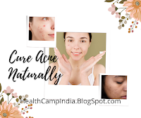 https://healthcampindia.blogspot.com/2022/02/how-to-cure-acne-naturally-best-home.html