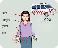 animation showing red flage signs of burn cases to consult a doctor immidiatly