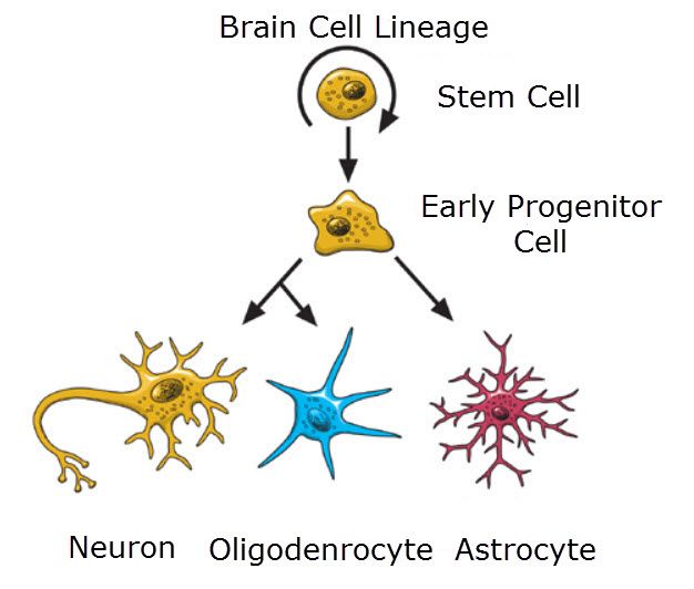 Cause of Oligodendroglioma