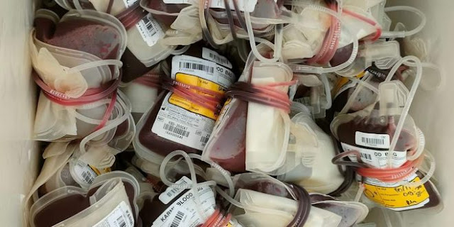 Foto: Kantong darah yang terkumpul pada pelaksanaan donor darah ASN Pemerintah Aceh.
