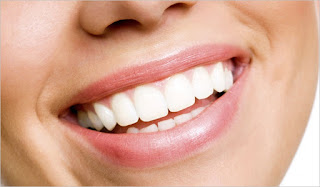 Quy trình niềng răng mặt trong tiêu chuẩn-2
