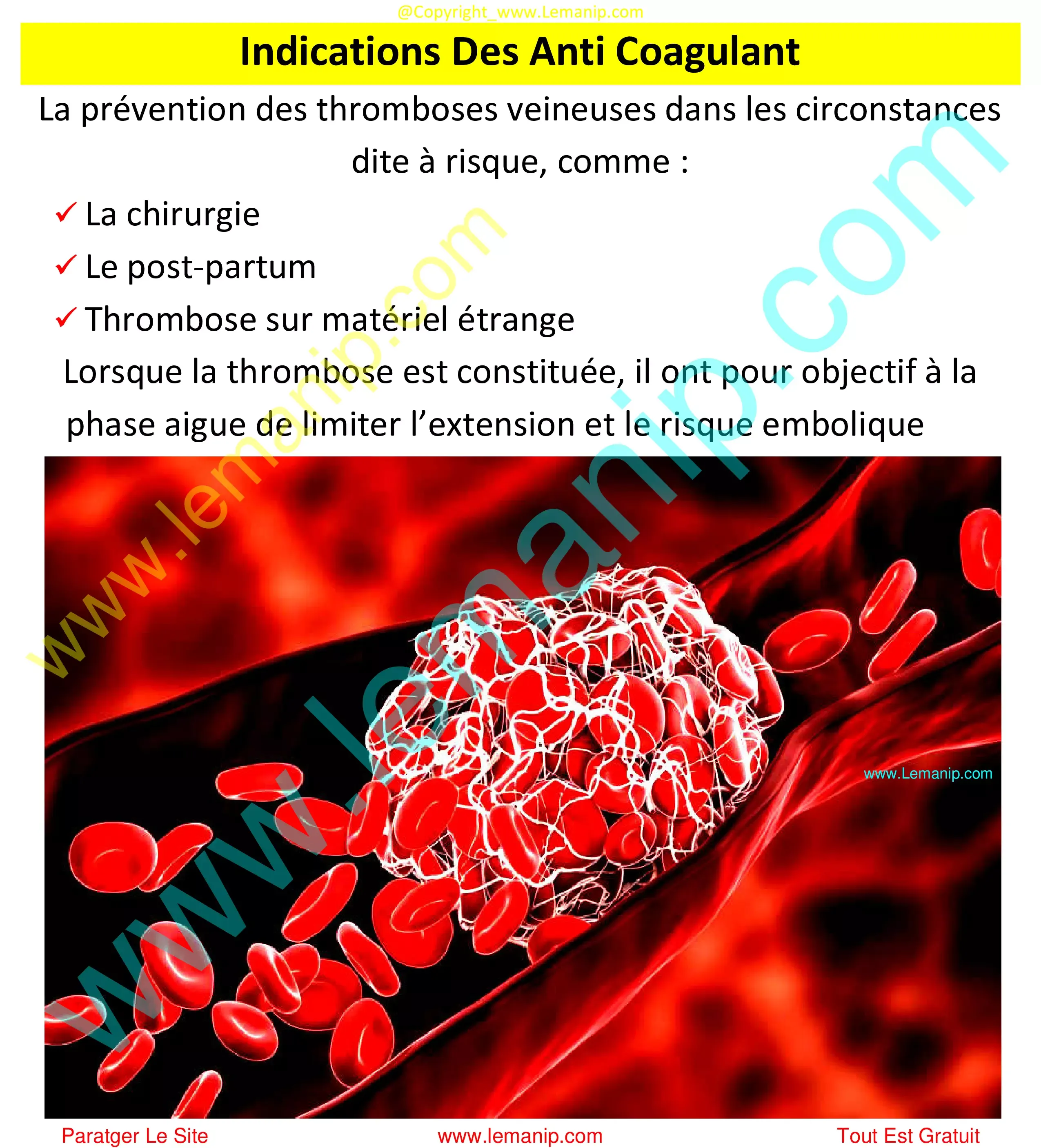 Indications Des Anti Coagulant