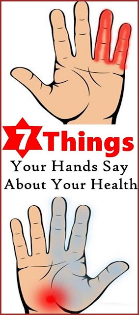 7 Things Your Hands Say About Your Health