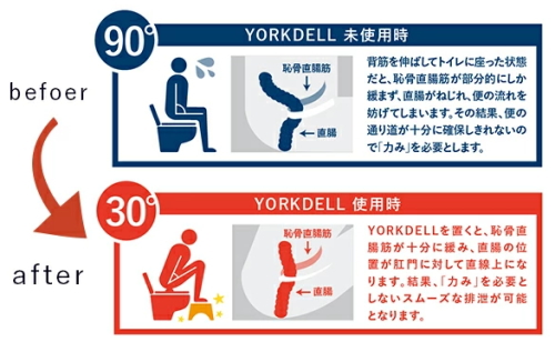 トイレ用サポート足置き台　ヨークデル　4573306862758