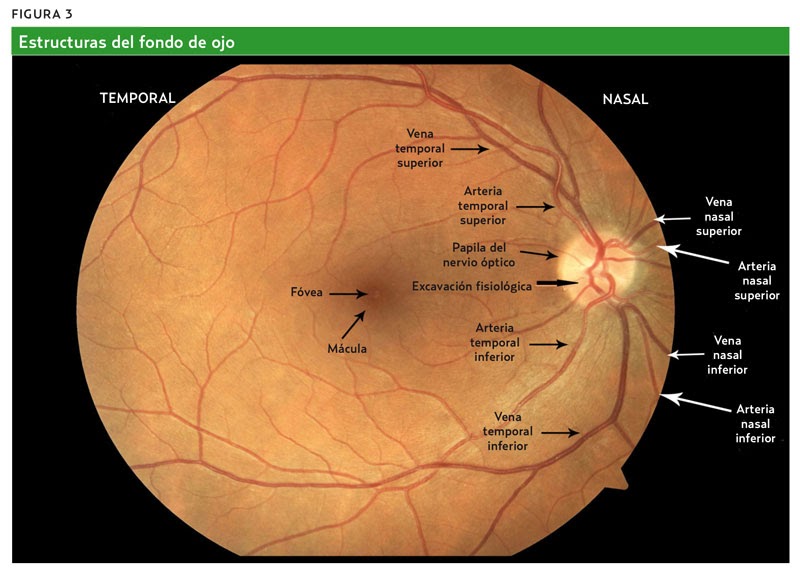 Medicina y Melodía: Fondo de ojo