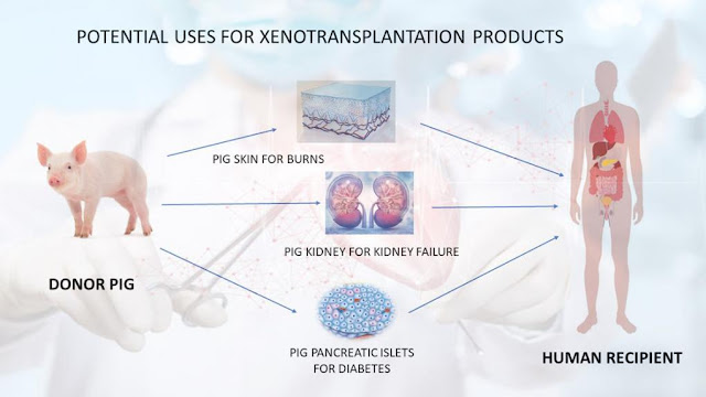 Chart describing uses for xenotransplantation