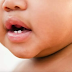 Cirurgia para correção de 'língua presa' é oferecida de graça para bebês e crianças em Salvador