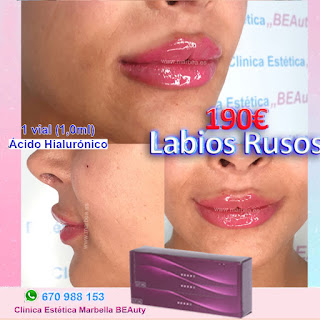 Labios ruso en Marbella