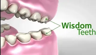 Benefits of Wisdom Teeth