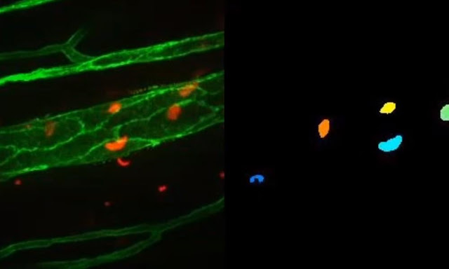 neutrophil-segmentation