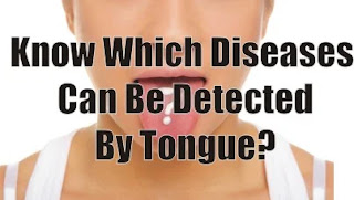 Know Which Diseases Can Be Detected By Tongue?