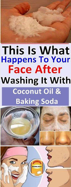 This Is What Happens To Your Face, After Washing & Coconut Oil & Baking Soda