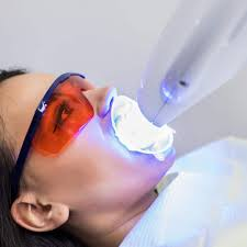 Laser teeth whitening at Dental Planet