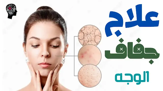 طريقة علاج جفاف الوجه