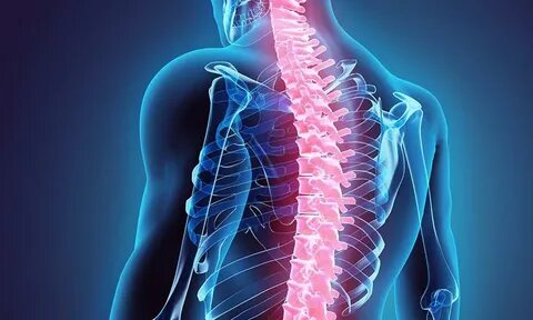 SPONDYLOSIS CAUSES AND ITS TREATMENT