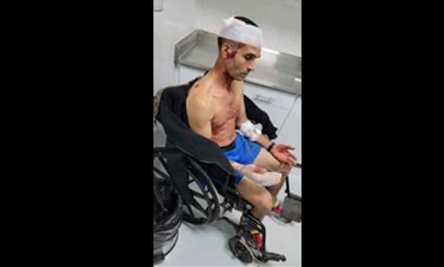Pedro Guzman herido en silla de ruedas