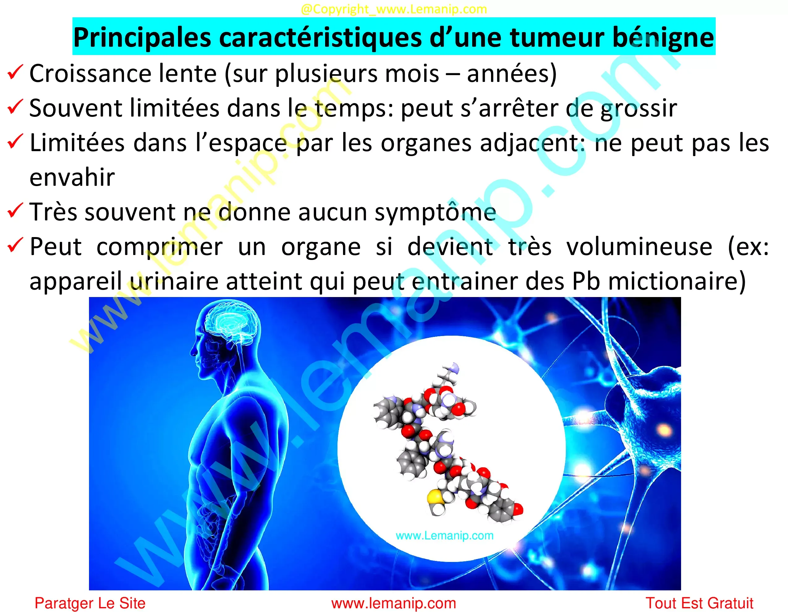 caractéristiques tumeur bénigne