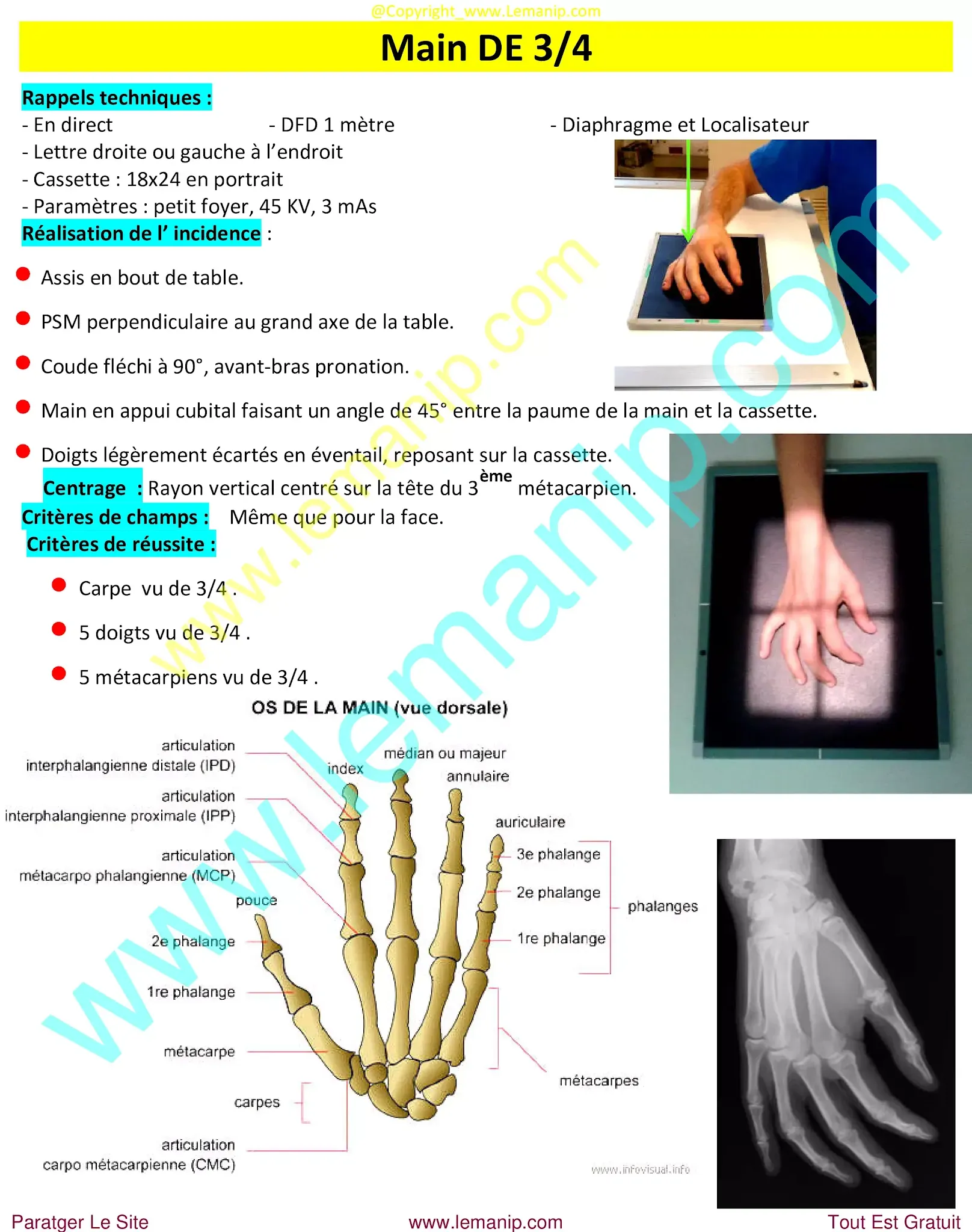 avant bras,elbow pain orthopedic doctor,dr henry hand and wrist,elbow pain treatment near me,premier orthopedics hand specialist,bras avant,hand man,orthopedic hand,orthopedic wrist,orthopedic elbow,orthopedic carpal tunnel