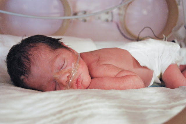 Premature Baby - Copyright Simply Suppa