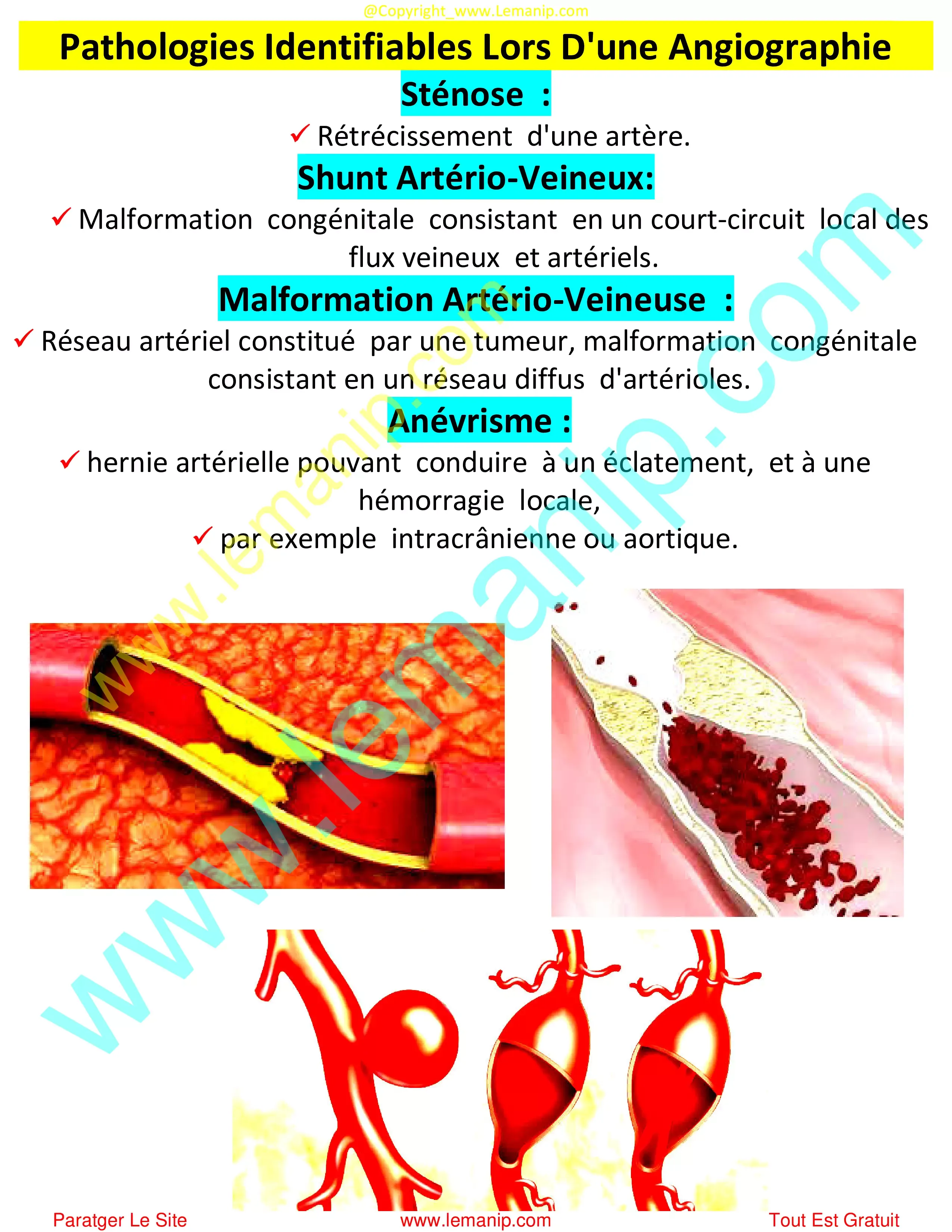 Pathologies Identifiables Lors D'une Angiographie