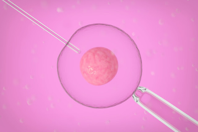 Passo a passo da fertilização in vitro e o que pode influenciar os resultados