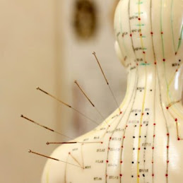 best acupuncture Melbourne