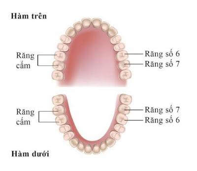 Răng cấm có nhổ được không? Có nên trồng lại? 1