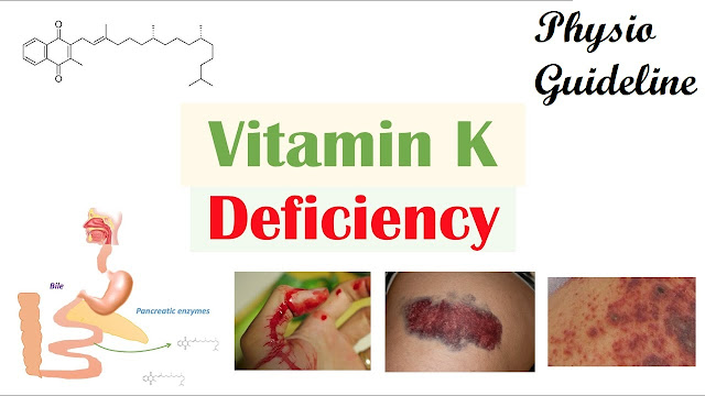 Vitamin K deficiency
