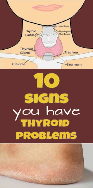 10 Signs You Have a Thyroid Problem and 10 Solutions For It