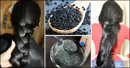 10 Ways to use Black Seed Oil for Hair Growth That Work Wonders