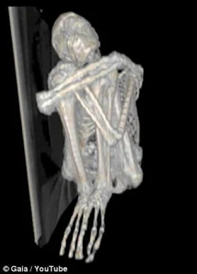 See, the ney sayers probably thought they wouldn't allow X-ray photo's of the mummified Alien being.