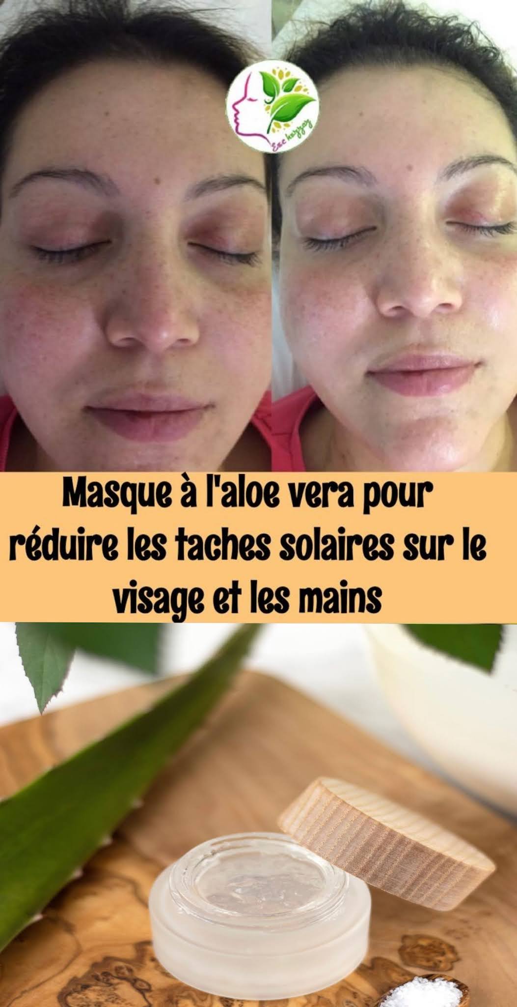 Masque à l'aloe vera pour réduire les taches solaires sur le visage et les mains