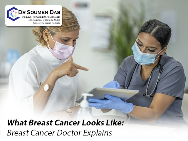 breast cancer doctor