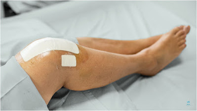 knee surgery, knee replacement, knee reconstruction, knee pain