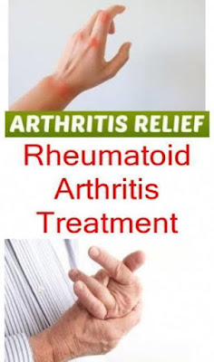 Natural Remedies for Arthritis For A Safer Alternative