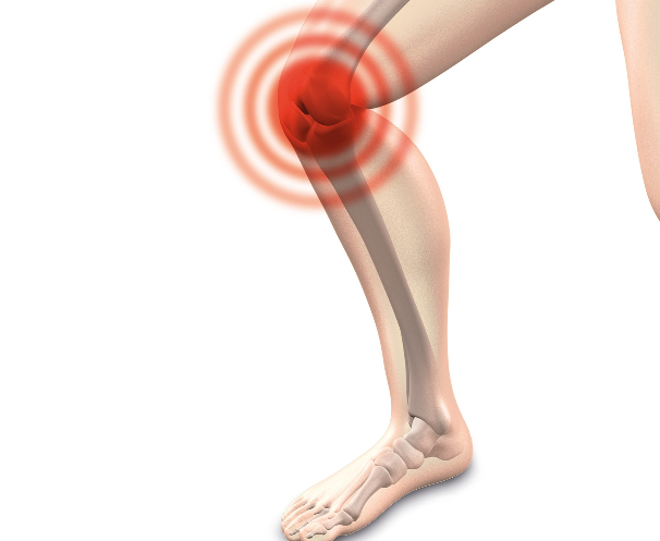 A Comprehensive Guide to Knee Pain Relief and What You Can Do to Decrease the Severity of It