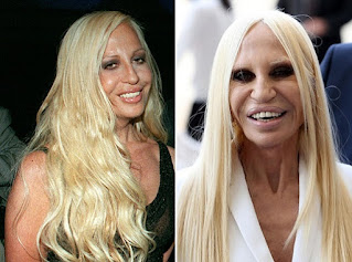 Top 20 Celebrities Have Ruined Their Looks With Plastic Surgery
