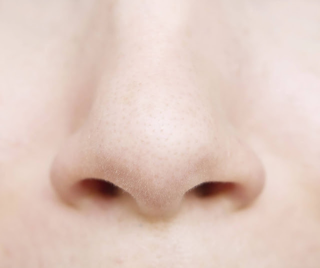 Loss of smell in Sjogren's syndrome