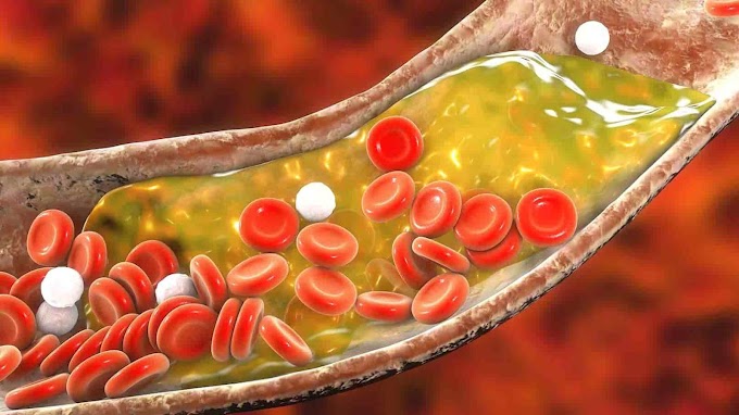 Cholesterol Control Tips: Eat These 5 Foods to Lower Cholesterol in 5 Days.