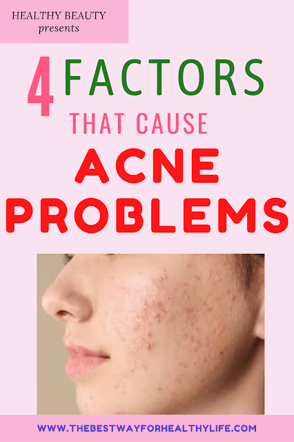 picture factors that cause acne problem