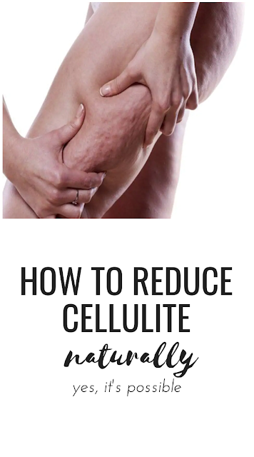 How to Reduce Cellulite Naturally